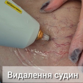 Фото с портфолио Delete