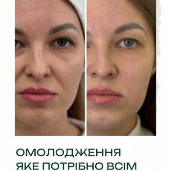 Фото с портфолио Elixir