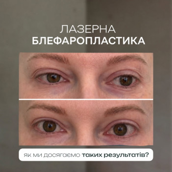Фото с портфолио Elixir