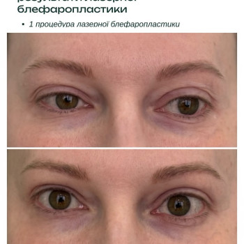 Фото с портфолио Elixir