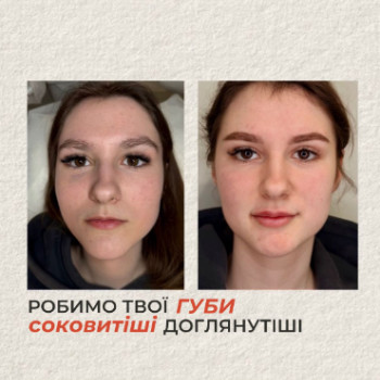 Фото с портфолио Glow