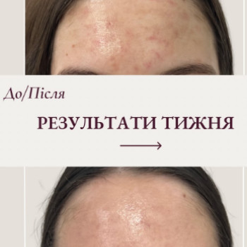 Фото с портфолио Rescue Skin