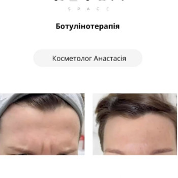 Фото с портфолио Botox Space