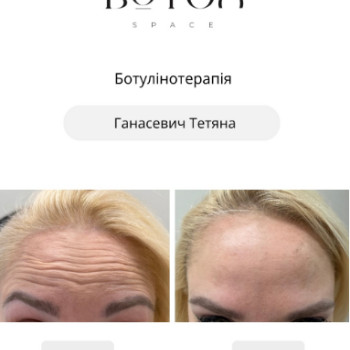 Фото с портфолио Botox Space