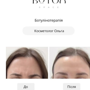 Фото с портфолио Botox Space