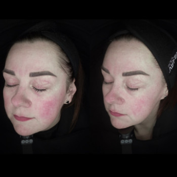 Фото с портфолио Botox Space