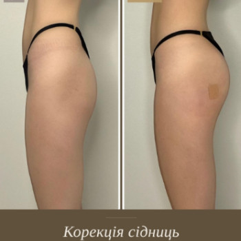 Фото с портфолио Panna Beauty