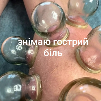 Знімаю гострий біль