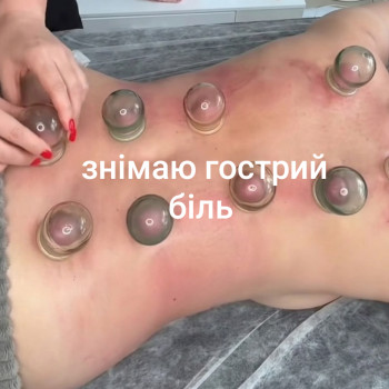 Знімаю гострий біль