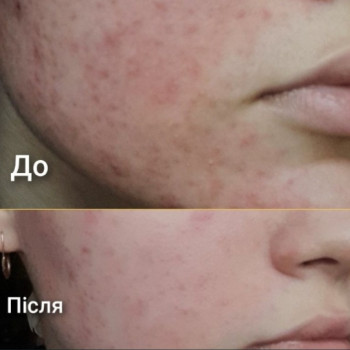 Фото с портфолио Віта Скляренко