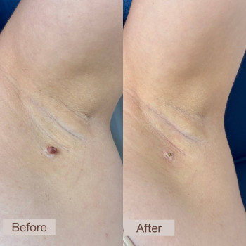 Фото с портфолио Dr.  Abraamyan Clinic
