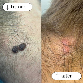 Фото с портфолио Dr.  Abraamyan Clinic