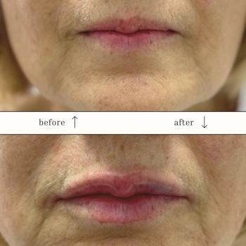 Фото с портфолио Dr.  Abraamyan Clinic