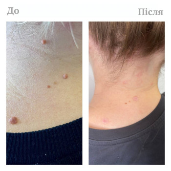 Фото с портфолио Dr.  Abraamyan Clinic