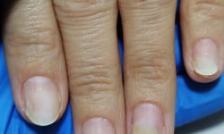 Подологический маникюр Подолог Анна Одесса