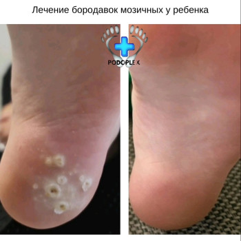Фото с портфолио Руслана Гончарова