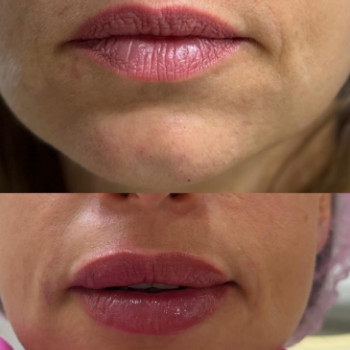 Фото с портфолио Cosmeta