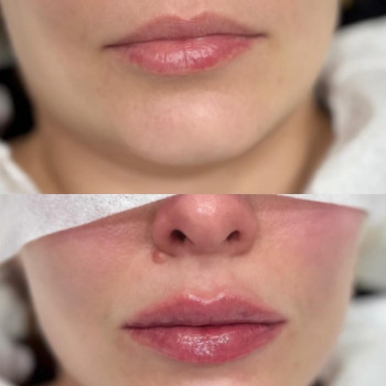 Фото с портфолио Cosmeta