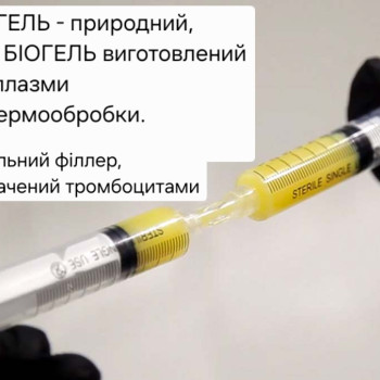 Фото с портфолио Мар'яна Мондзолівська