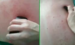 Массаж ГУАША Масажист Юлія Київ