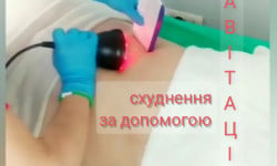 Кавитация Массажист Юлія Киев