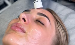 Микротоки + магнитотерапия для лица Косметології My Mass Київ
