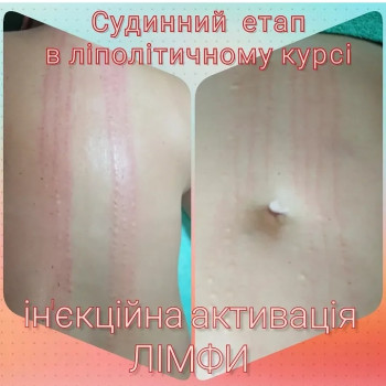 Фото с портфолио Юлія Гнатюк