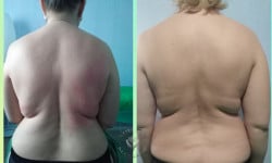 Массаж спины Массажист Юлія Киев