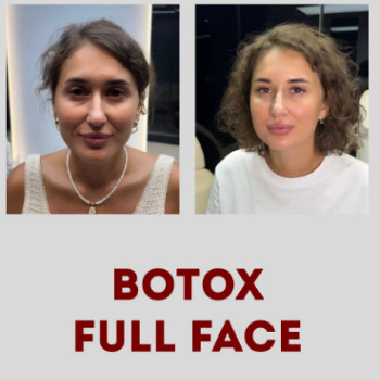 Фото с портфолио Shhh Beauty Clinic