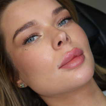 Фото с портфолио Shhh Beauty Clinic