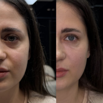 Фото с портфолио Shhh Beauty Clinic