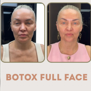 Фото с портфолио Shhh Beauty Clinic