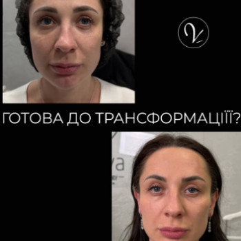 Фото с портфолио Dr. Volkova