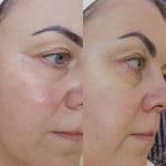 Уход  за чувствительной кожей Косметолог-эстетист Людмила Харьков
