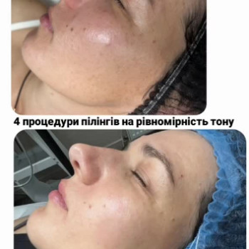 Фото с портфолио Laser Lux