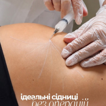 Фото с портфолио Комплимент