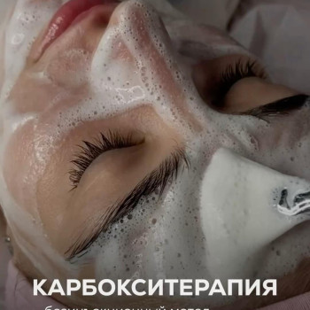 Карбоксі терапія