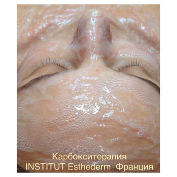 Фото с портфолио Оксана Анпилова