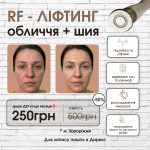 RF-Ліфтінг Студия красоты Энжой Запорожье