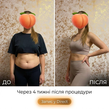 Фото с портфолио Энжой