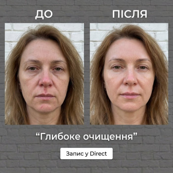 Фото с портфолио Енжой