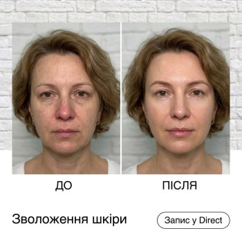 Фото с портфолио Енжой
