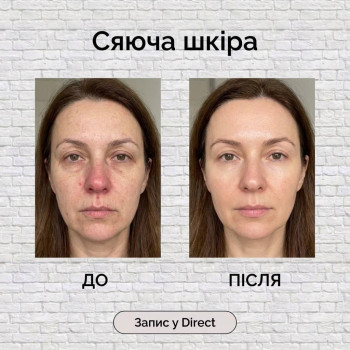 Фото с портфолио Енжой