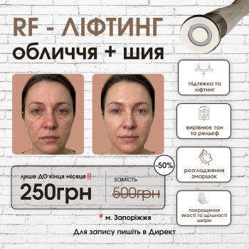 Фото с портфолио Енжой