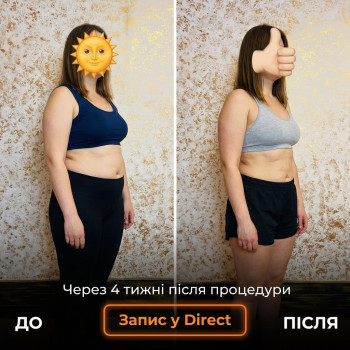Фото с портфолио Энжой