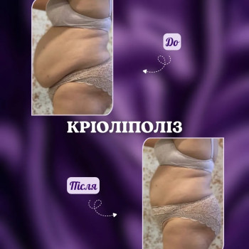 Фото с портфолио Энжой