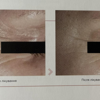 Фото с портфолио Наталья Поддубко
