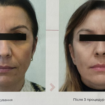 Фото с портфолио Наталя Піддубко