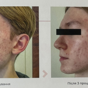 Фото с портфолио Наталя Піддубко