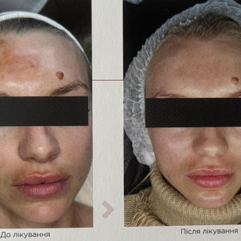 Фото с портфолио Наталья Поддубко